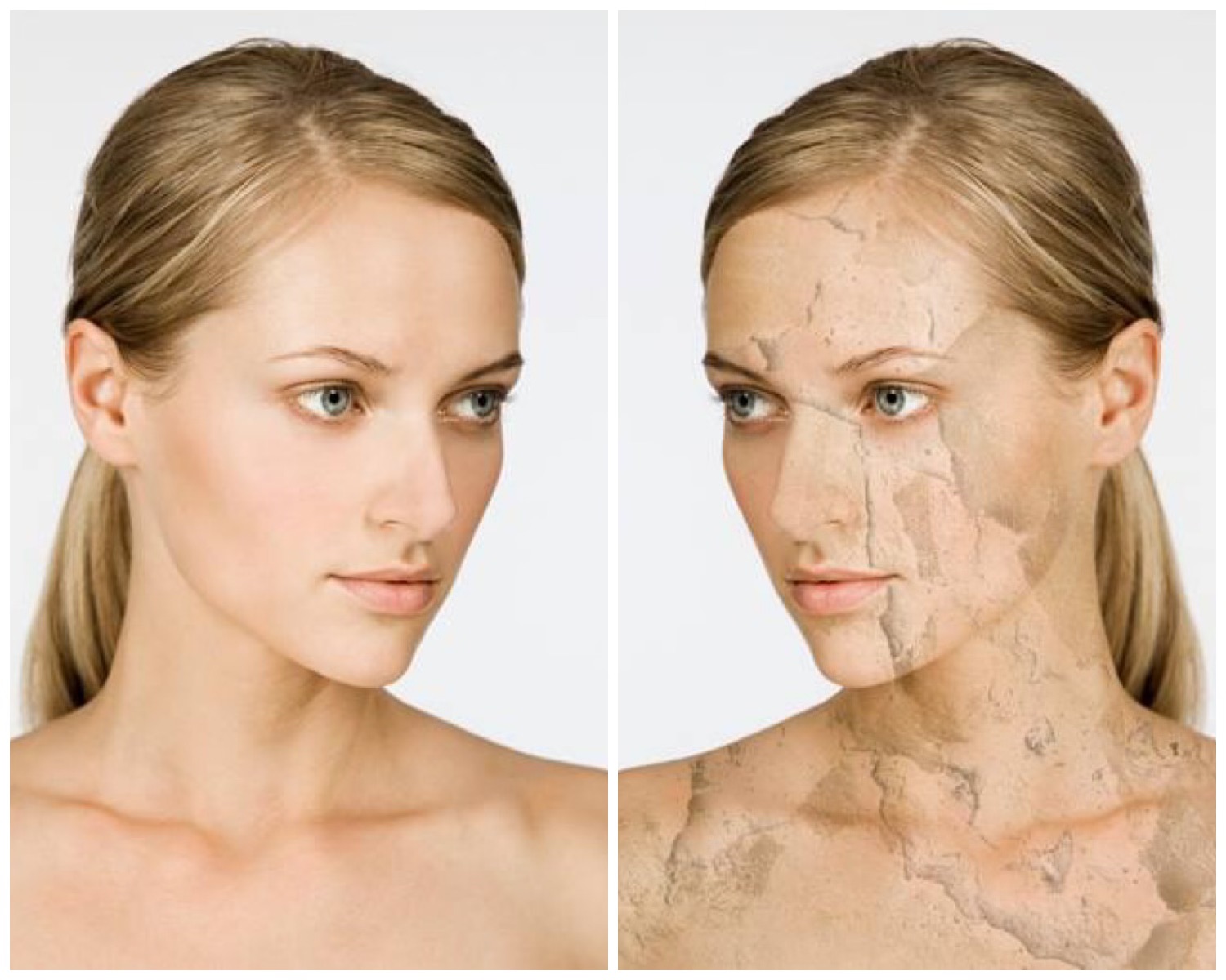Правильно подобранные процедуры после солнца необходимы, чтобы защитить кожу от фотостарения